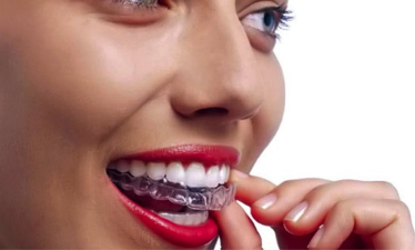 Okluzalni splintovi i štitnici za zube