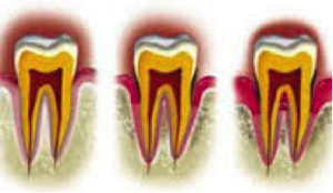 Parodontologija2